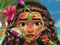 Jeu Docteur de la peau Moana en ligne